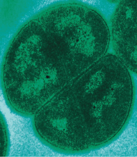 Vi khuẩn Deinococcus Radioduran Vi khuẩn Deinococcus Radioduran
