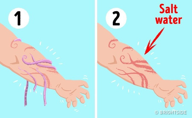 bi-kip-sinh-ton-2 Rửa sạch vết thương bằng nước muối.