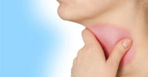 Cách chữa viêm họng hữu hiệu vào mùa đông